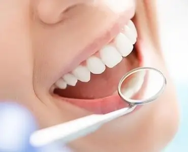 Estética dental en Madrid