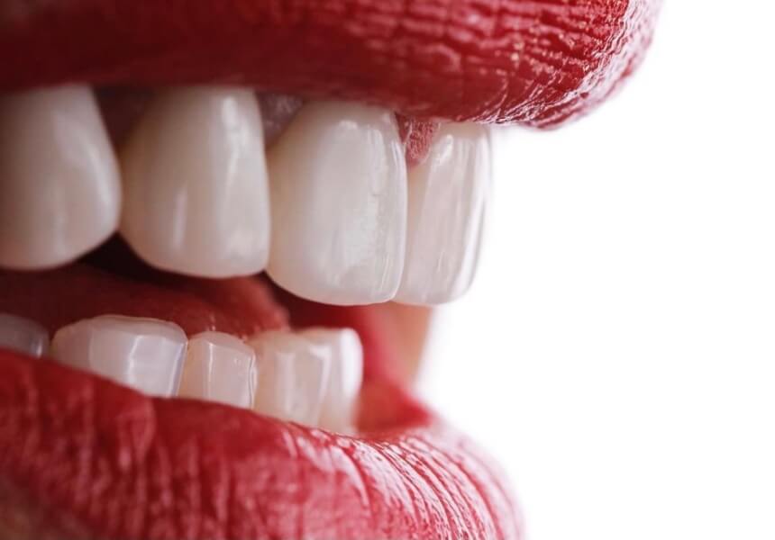 imagen1 invisalign